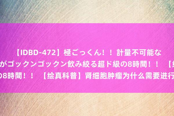 【IDBD-472】極ごっくん！！計量不可能な爆量ザーメンをS級女優がゴックンゴックン飲み絞る超ド級の8時間！！ 【绘真科普】肾细胞肿瘤为什么需要进行分子分型？